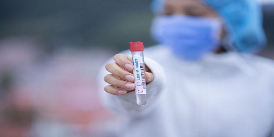 Ένας θάνατος και 60 νέα κρούσματα κορωνοϊού στην Κύπρο thumb