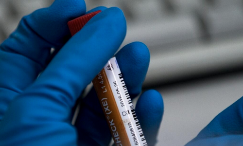 Πέντε χρόνια αποκλεισμός για αθλητή του στίβου!  thumb